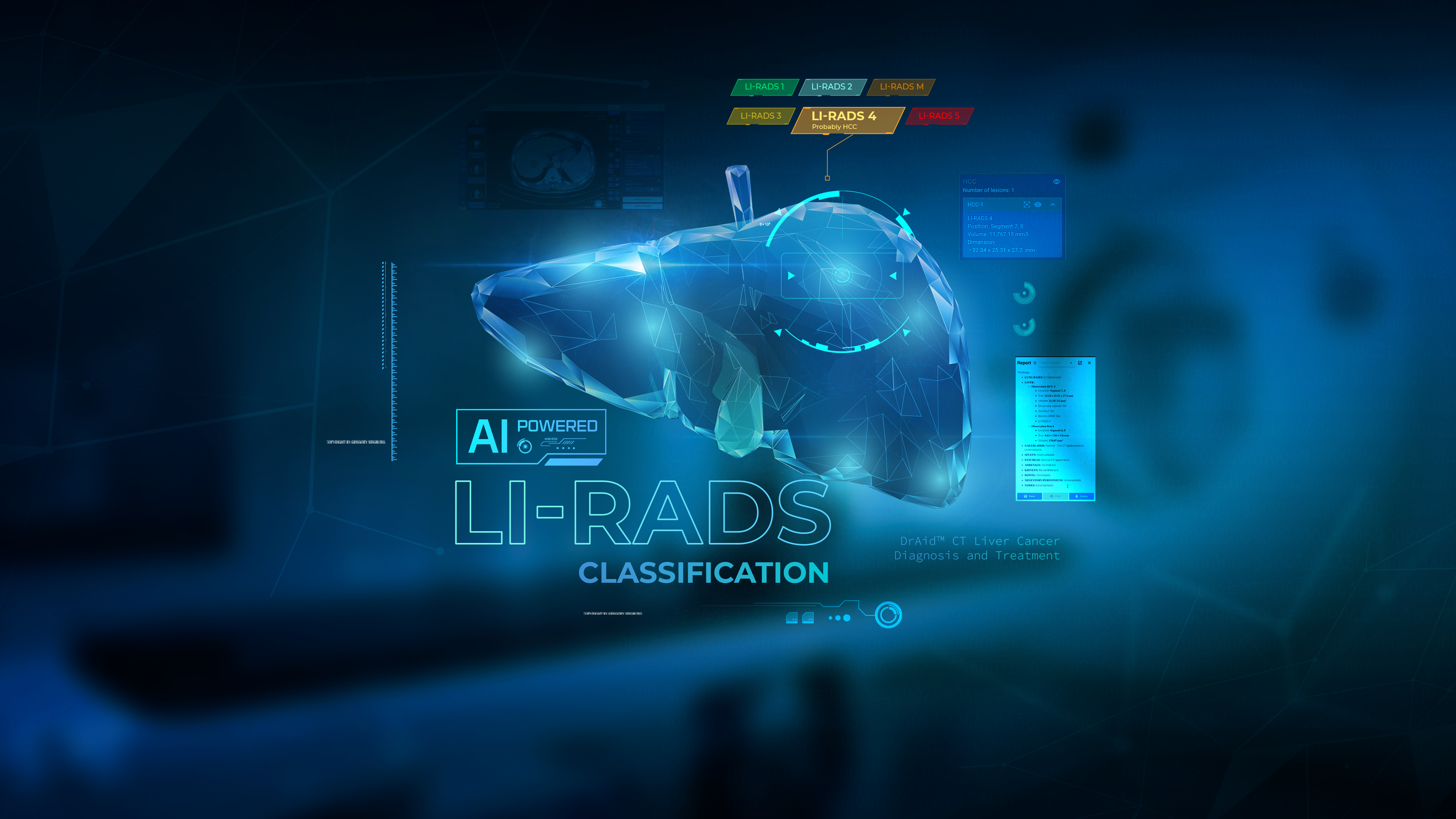 NEW FEATURE ANNOUNCEMENT: VinBrain Officially Launches LI-RADS Classification Feature on DrAid™ CT Liver Cancer D&T